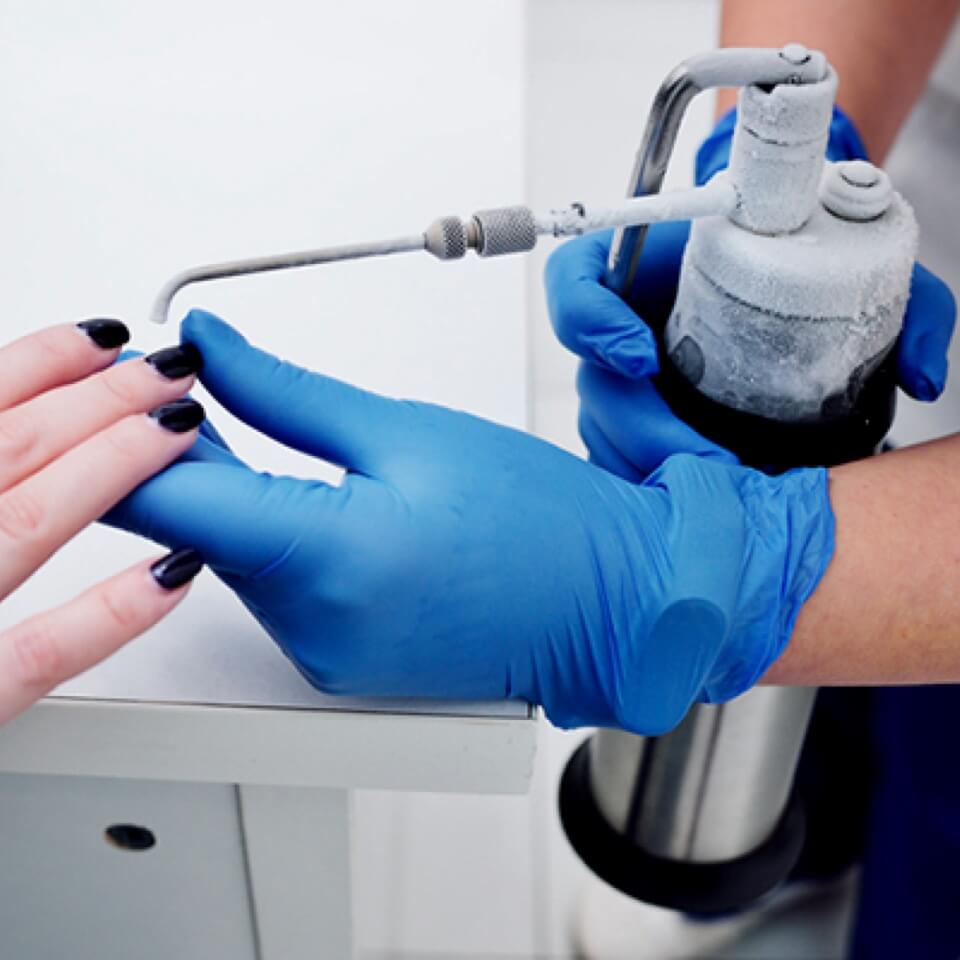 Crioterapia riabilitativa